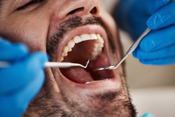 Best Emergency Dental Care for Broken or Chipped Teeth in Atkins, AR