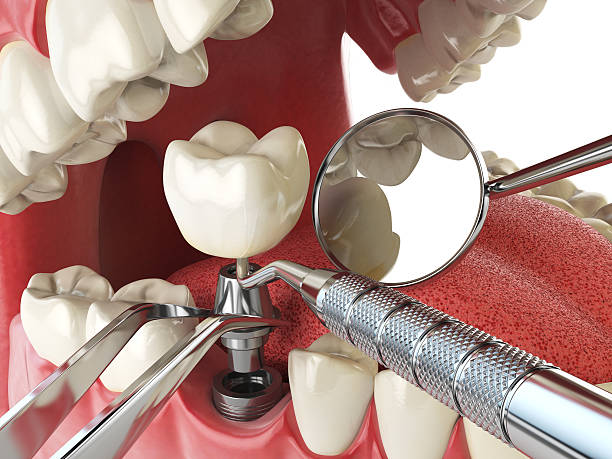 Best Weekend Emergency Dentist in Atkins, AR