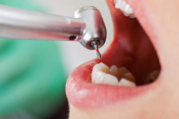 Best Emergency Tooth Extraction in Atkins, AR